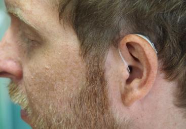 Close up of a man's head, wearing a hearing aid