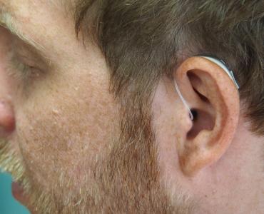 Close up of a man's head, wearing a hearing aid