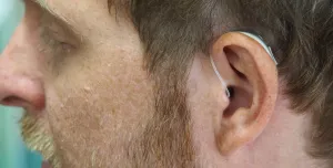 Close up of a man's head, wearing a hearing aid